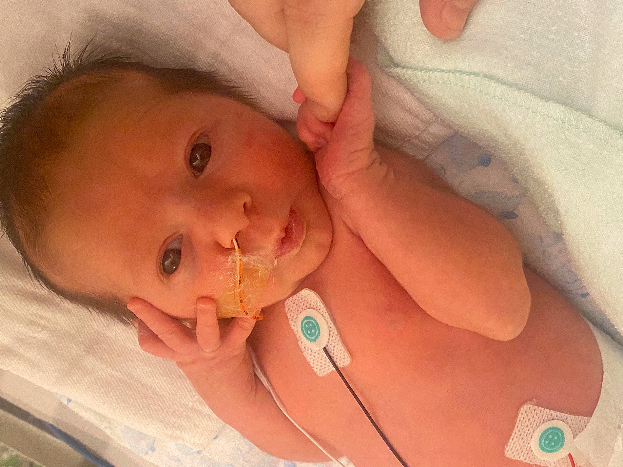 Emmalyn is registered to the contest to win money with this photo: baby, cheek, chin, comfort, ear, eye, eyebrow, face, facial_expression, finger, hair, head, human_body, iris, lip, mammal, mouth, neck, nose, person