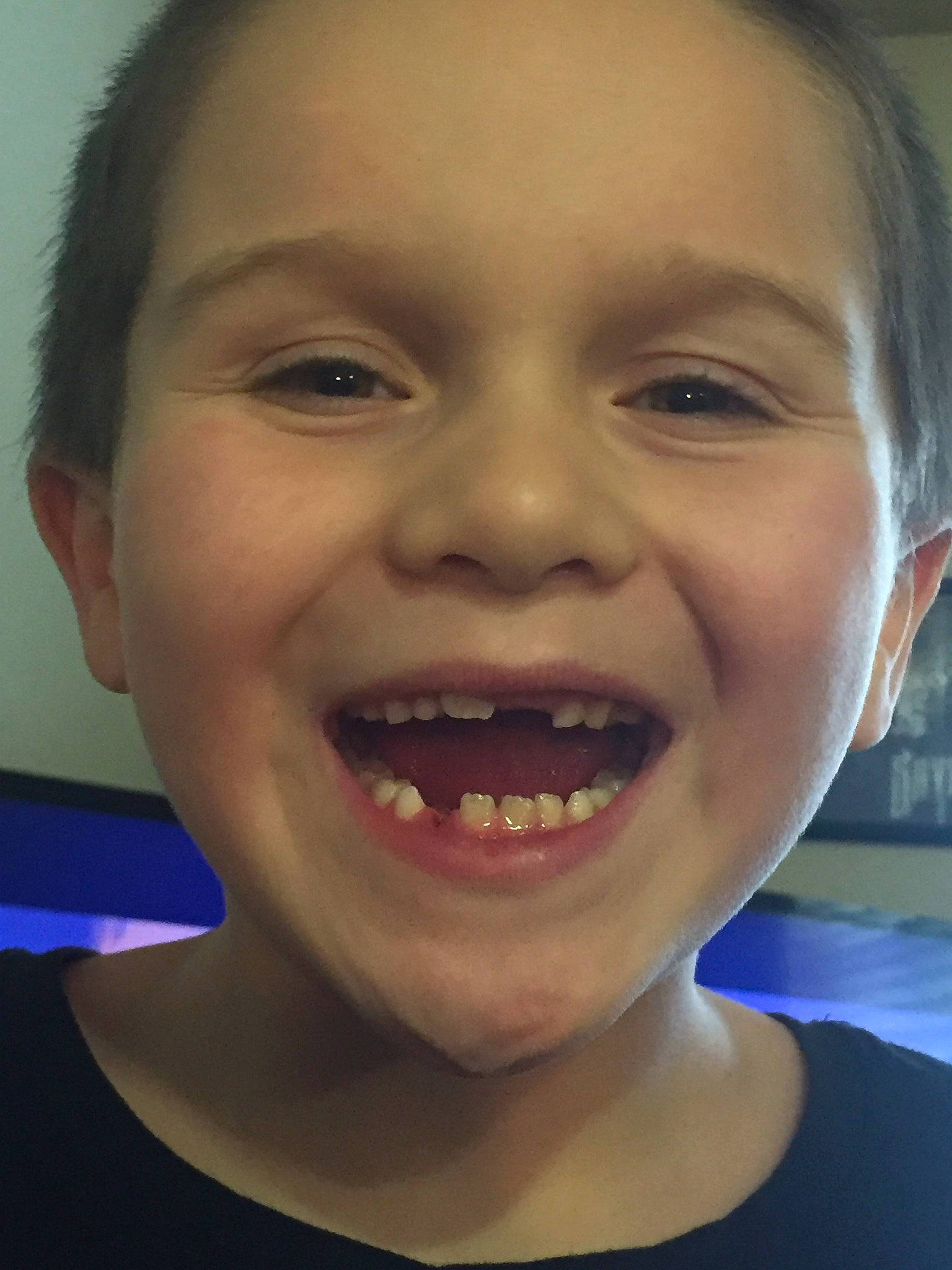 Kyler is registered to the contest to win money with this photo: cheek, child, chin, eyebrow, face, facial_expression, forehead, fun, head, human_body, jaw, joy, laugh, lip, mouth, nose, organ, person, skin, smile