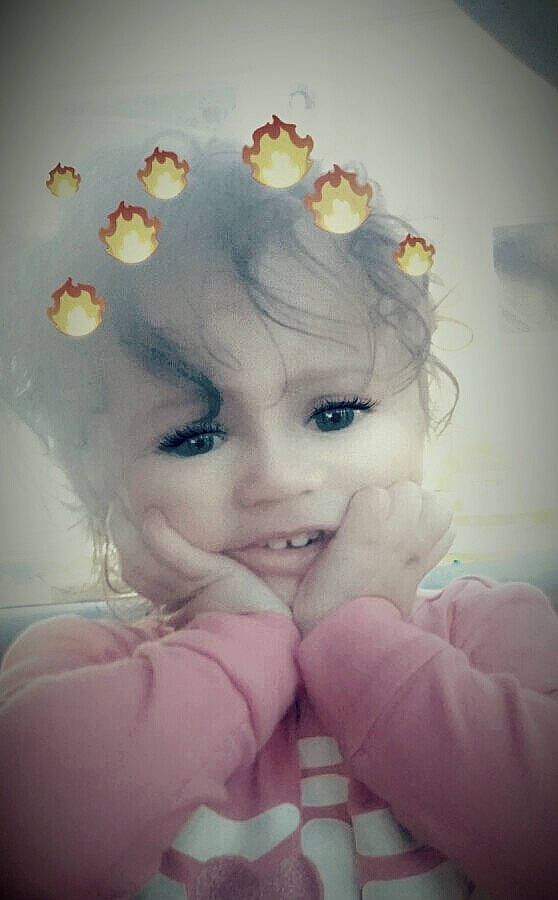 Lillie is registered to the contest to win money with this photo: beauty, cheek, child, close_up, eye, face, flower, forehead, girl, hair_accessory, head, human_hair_color, infant, iris, mouth, nose, person, pink, skin, smile