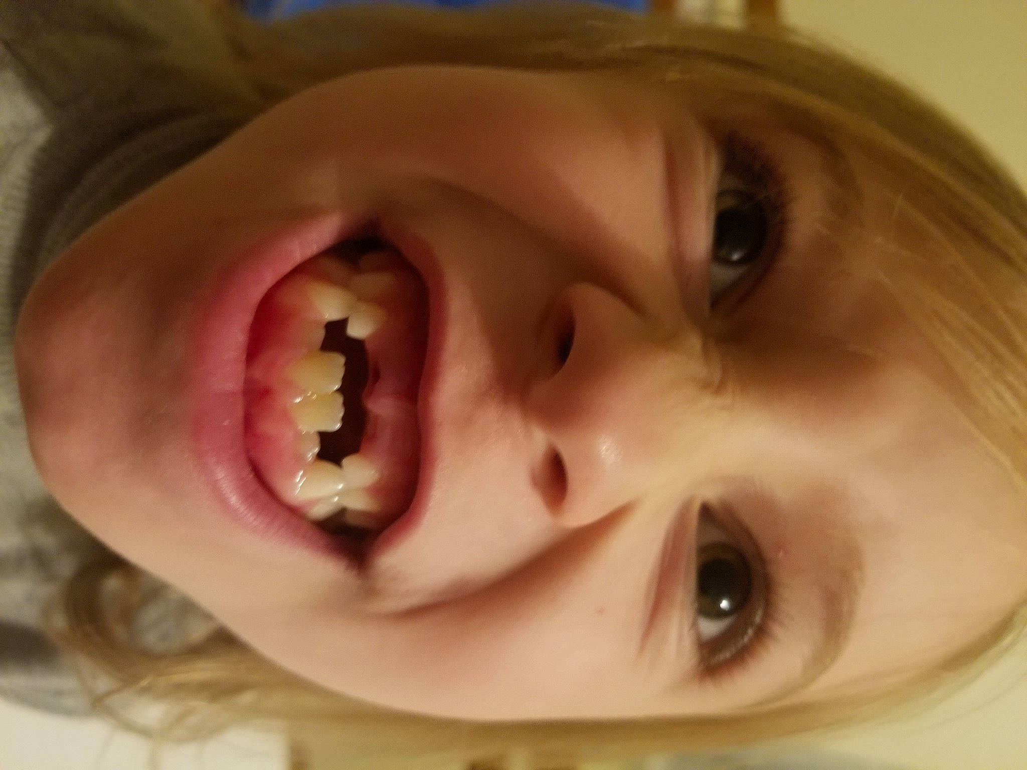 Naomie a rejoint le concours — aidez-le/la à gagner de superbes lots ! cheek, chin, ear, eye, eyebrow, eyelash, forehead, gesture, happy, human_body, iris, jaw, lip, mouth, neck, nose, organ, skin, smile, tooth