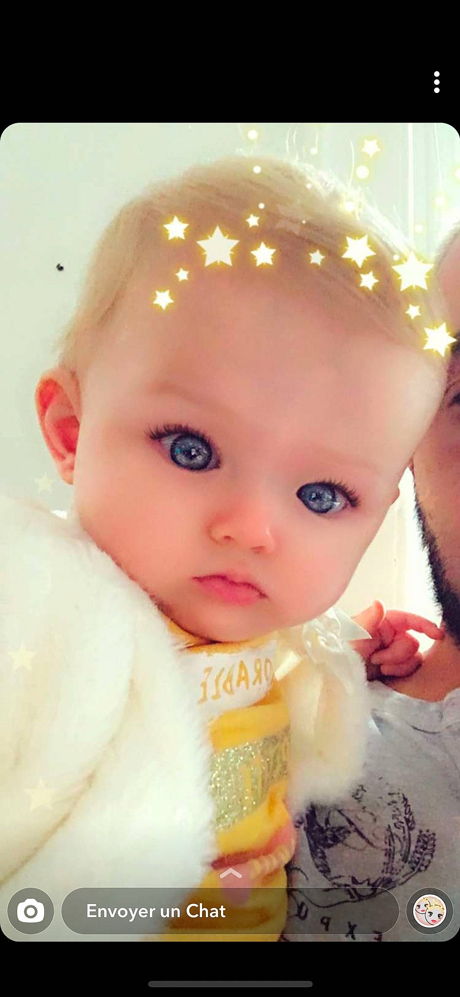 Maiwen participe au concours pour gagner de l'argent avec cette photo : baby, baby_toddler_clothing, cheek, child, child_model, chin, eyebrow, eyelash, forehead, hair_accessory, headband, headpiece, iris, lip, person, portrait_photography, skin, toddler, yellow