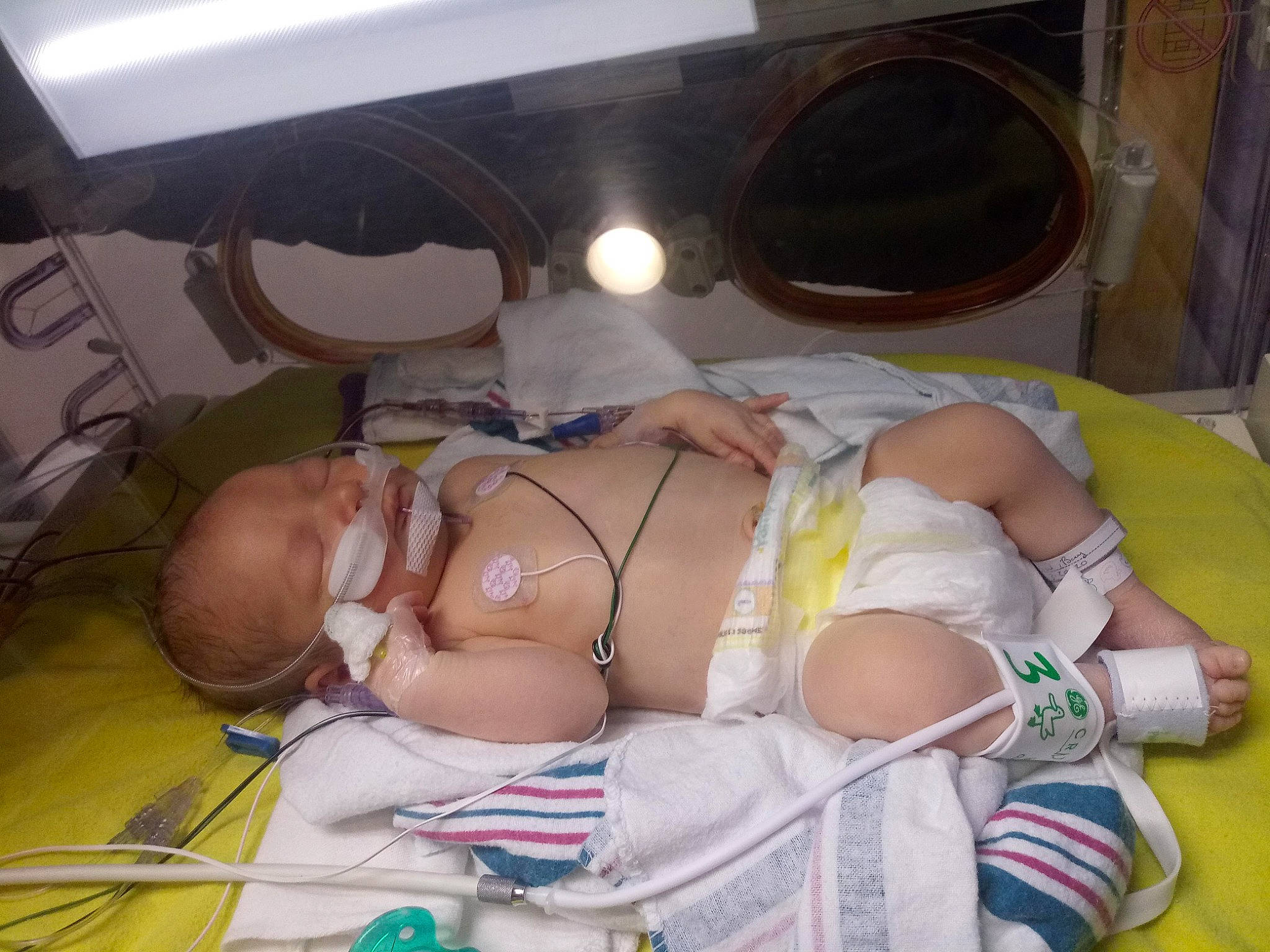 Todd joined the competition — help win amazing prizes! baby, birth, child, childbirth, leg, person