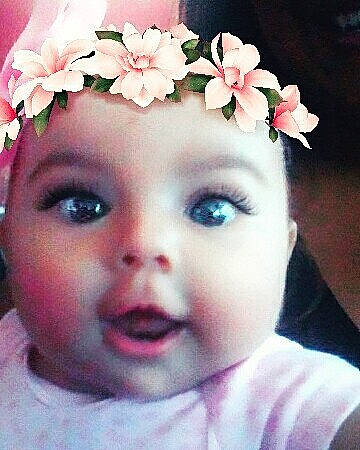 Ava joined the competition — help win amazing prizes! cheek, child, ear, eye, eyebrow, face, flower, forehead, girl, hair_accessory, head, headband, headpiece, infant, lip, nose, person, petal, pink, skin