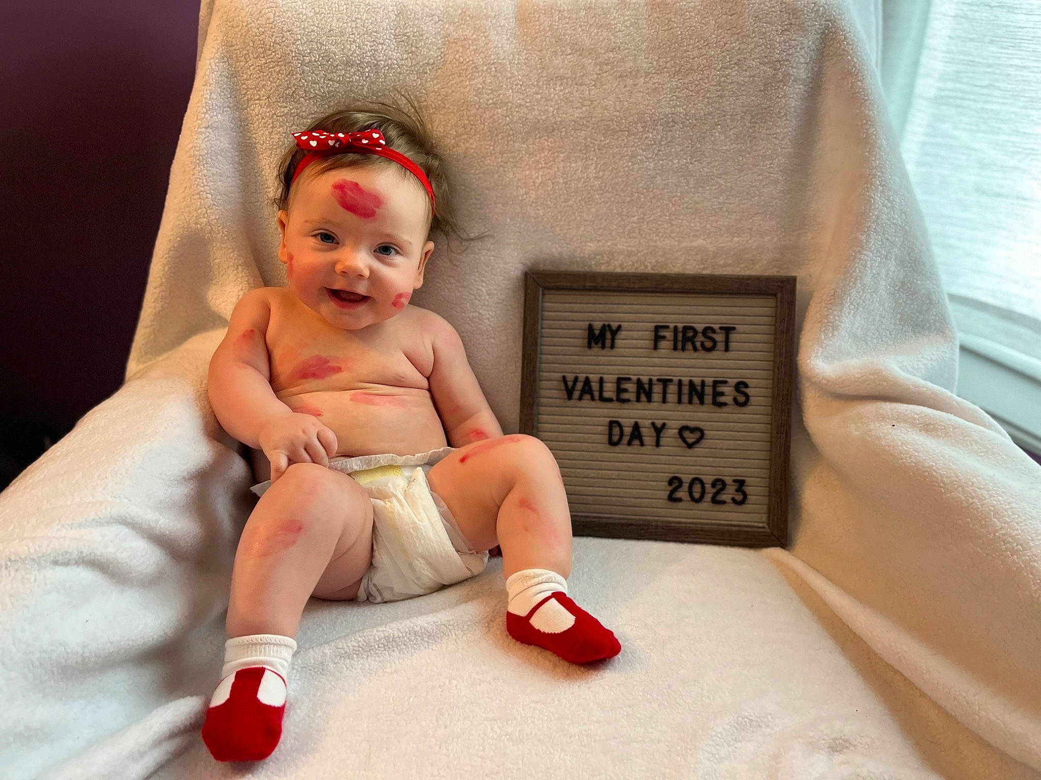 Emma joined the competition — help win amazing prizes! baby, baby_toddler_clothing, child, comfort, facial_expression, fashion_accessory, finger, foot, fun, happy, human_leg, knee, nail, person, sitting, skin, smile, textile, thigh, thumb