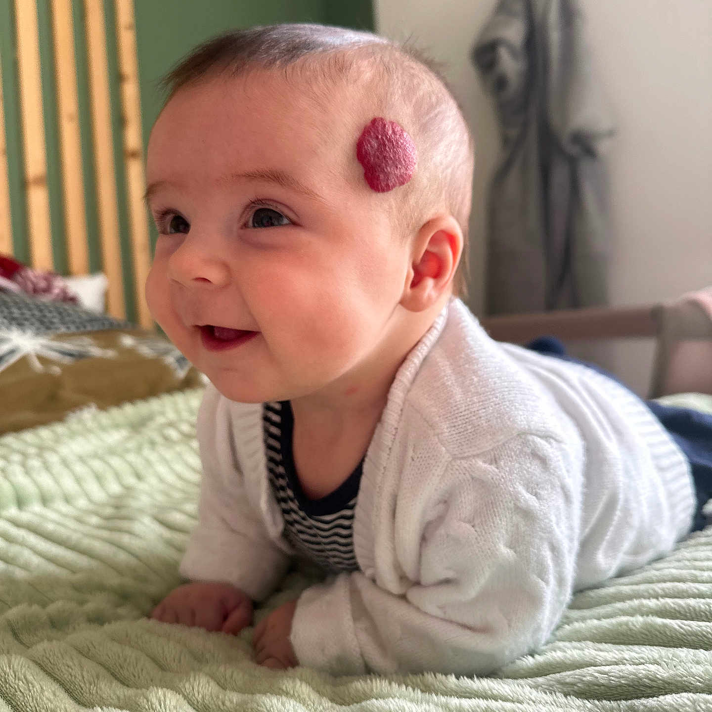 Rose participe au concours pour gagner de l'argent avec cette photo : baby, infant, smiling, face, head, cardigan, striped_shirt, red_mark, skin_patch, blanket, bed, indoor, soft_texture, curious, happy, child, portrait, crawling, furniture, cozy