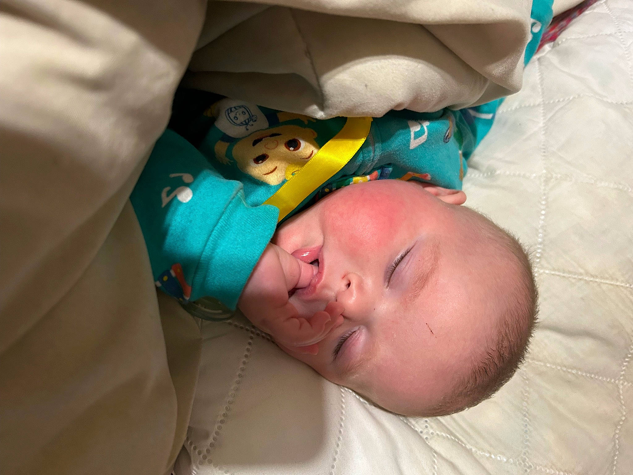 Hazel is registered to the contest to win money with this photo: abdomen, baby, baby_products, baby_toddler_clothing, child, comfort, event, eye, eyebrow, hat, health_care, hospital, linens, medical, medical_equipment, medical_procedure, person, room, service, skin