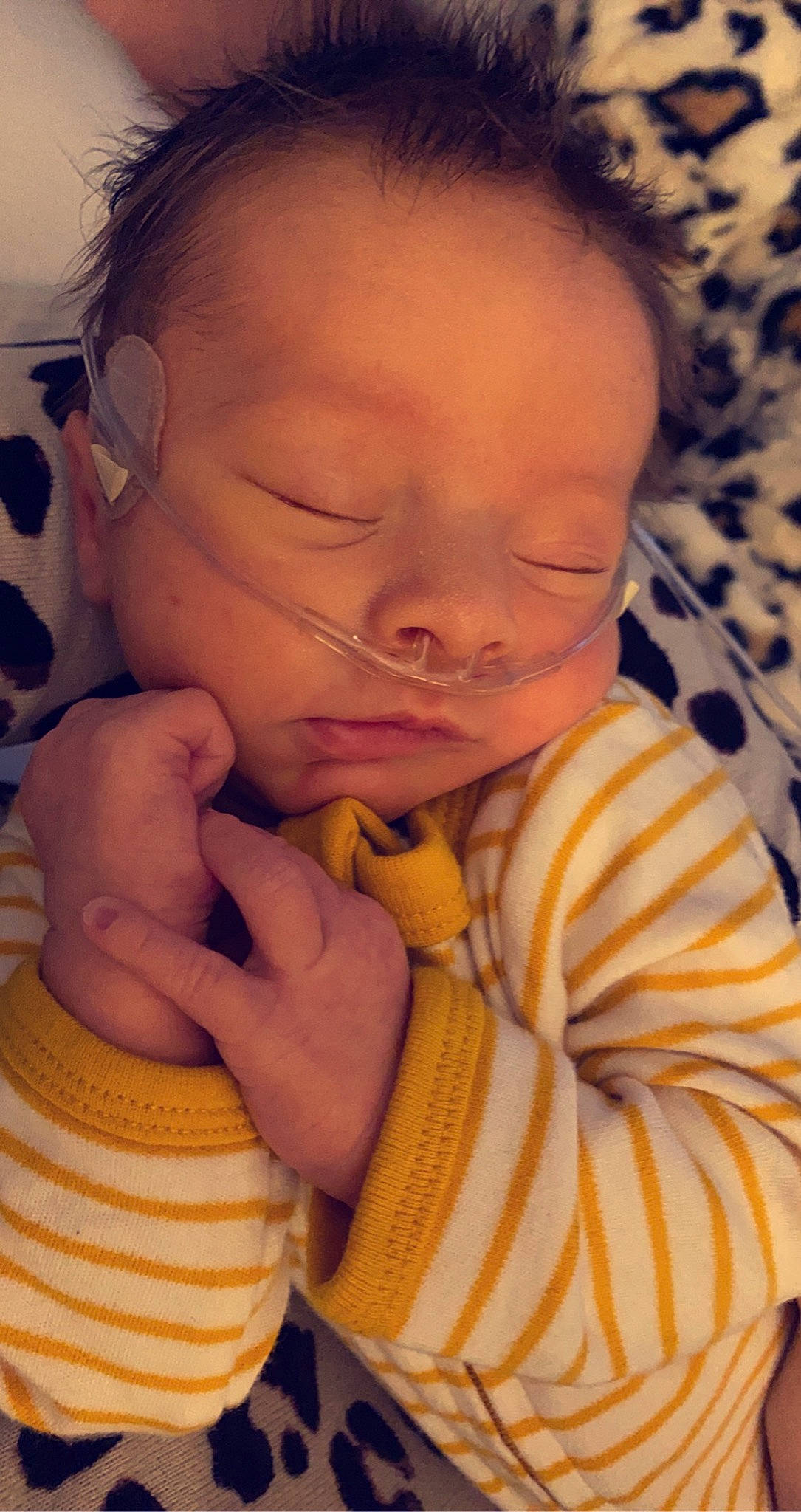 Graysen is registered to the contest to win money with this photo: arm, baby, baby_toddler_clothing, cheek, comfort, ear, eyelash, finger, forehead, gesture, hand, human_body, iris, lip, mouth, neck, nose, person, skin, sleeve