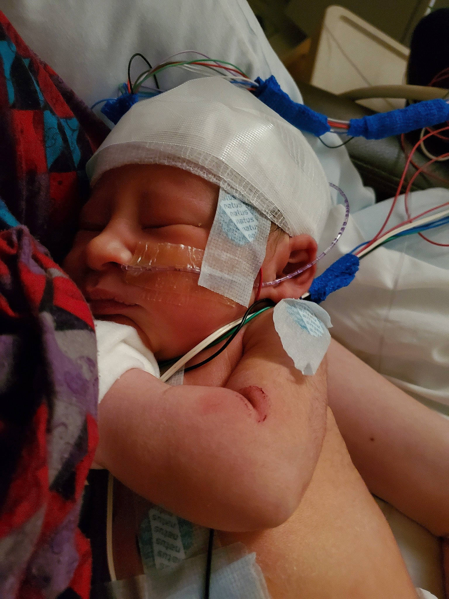 Oliver is registered to the contest to win money with this photo: baby, birth, child, childbirth, medical, medical_equipment, medical_procedure, nose, operating_theater, patient, person, room, service, surgeon