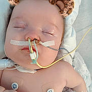 Phillip joined the competition — help win amazing prizes! baby, bandage, blanket, child, cute, digital_filter, face, hand, healthcare, hospital, infant, leopard_ears_filter, medical, monitoring, nose_tubes, patient, sensor, skin, sleeping, tubes