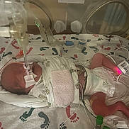 Grayson joined the competition — help win amazing prizes! newborn, baby, hospital, incubator, medical_tubes, blanket, footprints, infant, monitoring, diaper, swaddled, healthcare, patient, neonatal, bed, hospital_equipment, small, lying_down, fragile, care