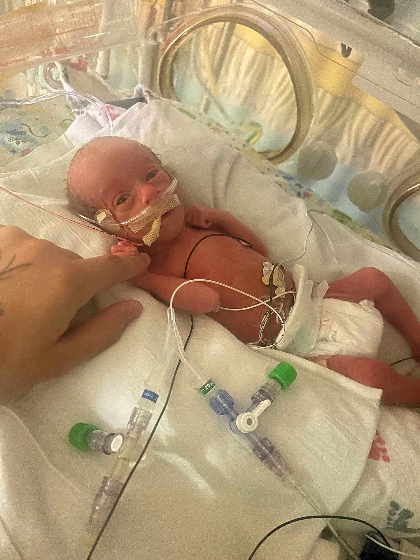 Grayson is registered to the contest to win money with this photo: premature_baby, incubator, medical_tubes, hand, newborn, diaper, hospital, monitoring_wires, fragile, baby_face, tiny, healthcare, patient, neonatal_unit, care, hospital_bed, skin, infant, medical_equipment, life_support