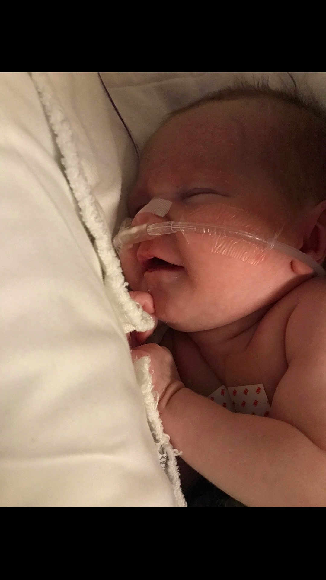 Tinsley is registered to the contest to win money with this photo: baby, infant, sleeping, nasal_tube, hospital, medical_tape, blanket, closeup, face, skin, child, newborn, resting, cute, healthcare, fragile, peaceful, indoors, person, soft