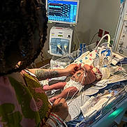 Nayloni joined the competition — help win amazing prizes! newborn, hospital, medical_equipment, incubator, monitor, tattoo, adult, hand, infant, patient, cables, bed, healthcare, care, person, tubes, nursery, premature_baby, life_support, clinic