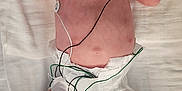 Emmalina is registered to the contest to win money with this photo: baby, infant, medical_equipment, hospital, monitoring_wires, nasal_cannula, diaper, bed, skin, newborn, healthcare, patient, hospital_bed, medical_care, person, lying_down, wrinkled_skin, head, hand, foot