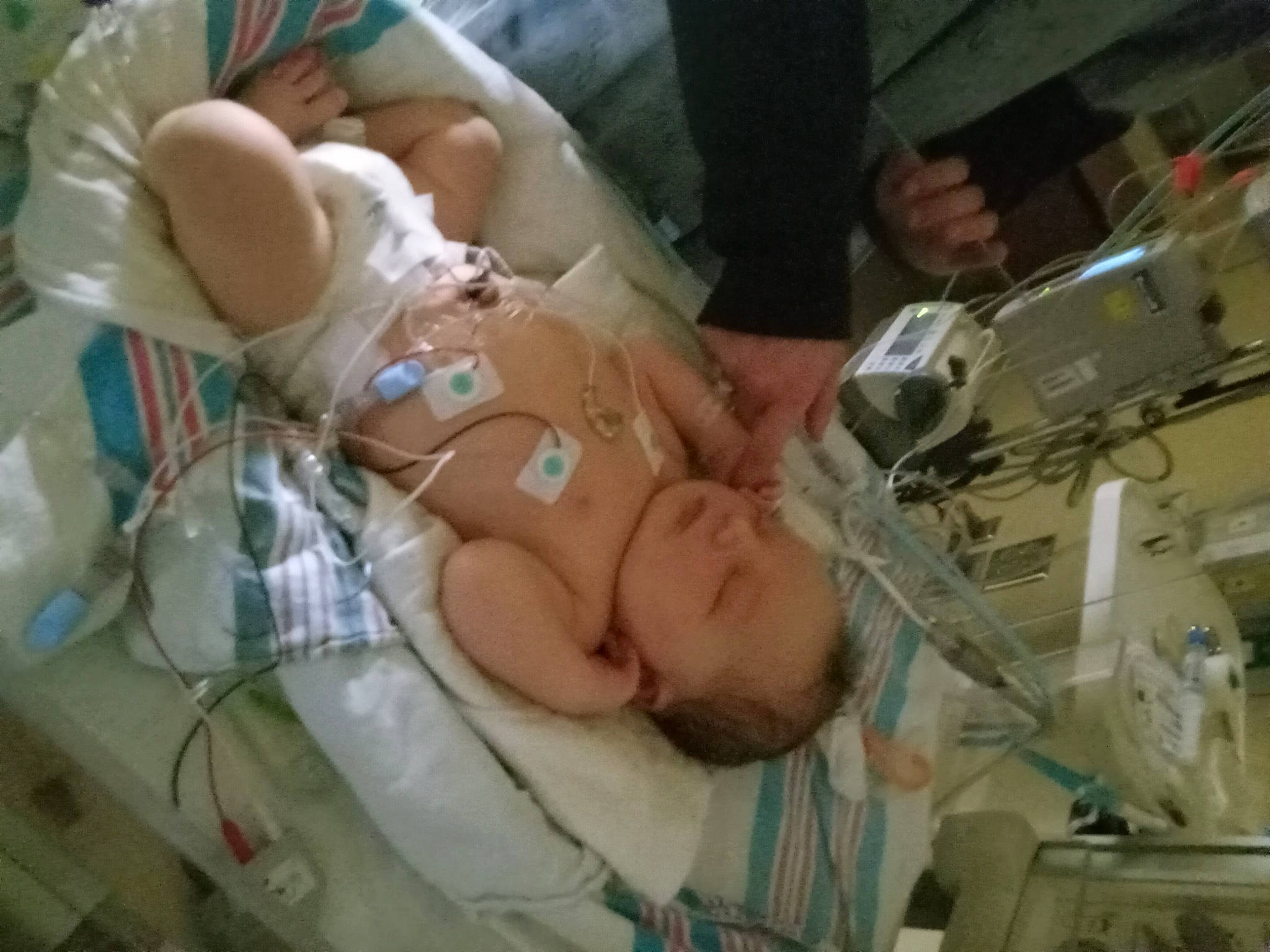 Colten is registered to the contest to win money with this photo: abdomen, baby, child, clinic, cosmetic_dentistry, event, health_care, health_care_provider, hospital, hospital_bed, medical, medical_assistant, medical_equipment, medical_procedure, patient, pediatrics, person, service, skin, surgeon