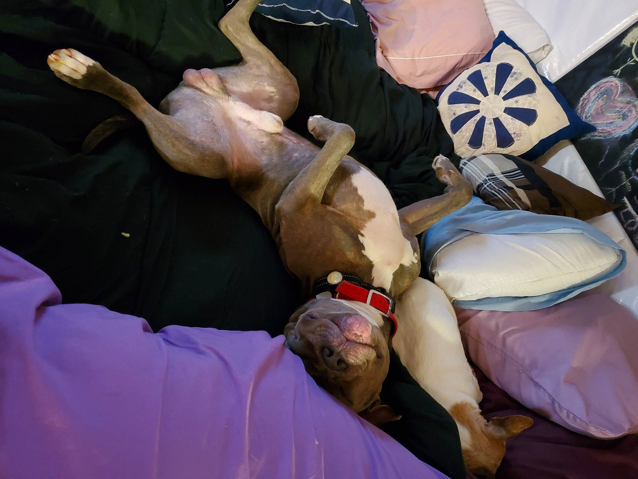 Buddy is registered to the contest to win money with this photo: art, elbow, event, finger, flag, foot, gesture, glove, health_care, human_leg, joint, knee, medical, medical_glove, medical_procedure, personal_protective_equipment, safety_glove, service, sports_gear, wrist