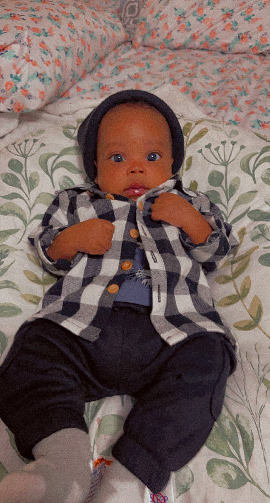 Mikel is registered to the contest to win money with this photo: baby, baby_toddler_clothing, cheek, child, comfort, doll, dress, hairstyle, iris, linens, lip, nail, nose, pattern, person, skin, sleeve, textile, thigh, toddler