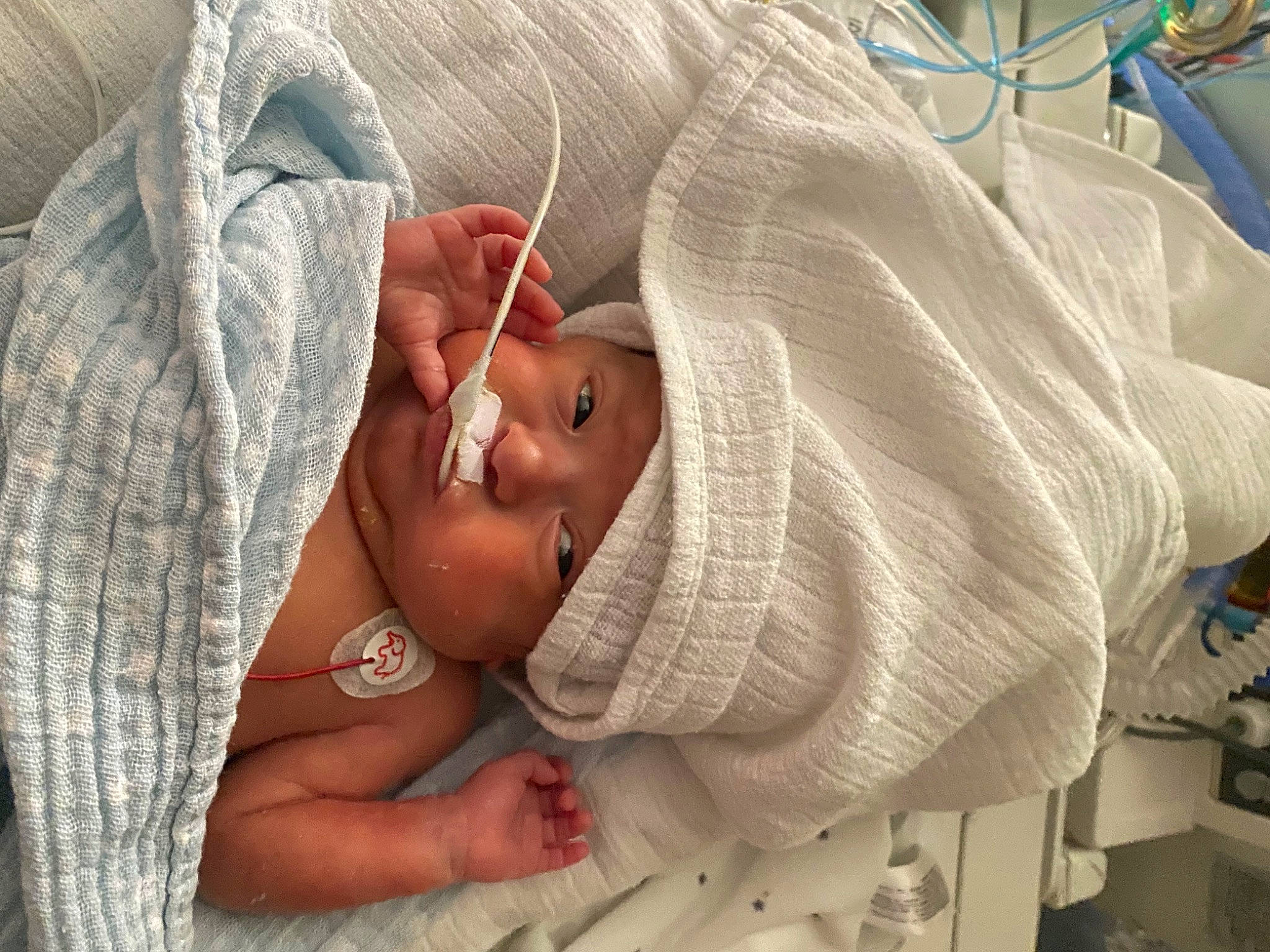 Ilhan participe au concours pour gagner de l'argent avec cette photo : arm, baby, baby_products, bed, child, childbirth, comfort, eye, facial_expression, hand, hat, head, headwear, hospital, linens, mouth, person, room, skin, textile