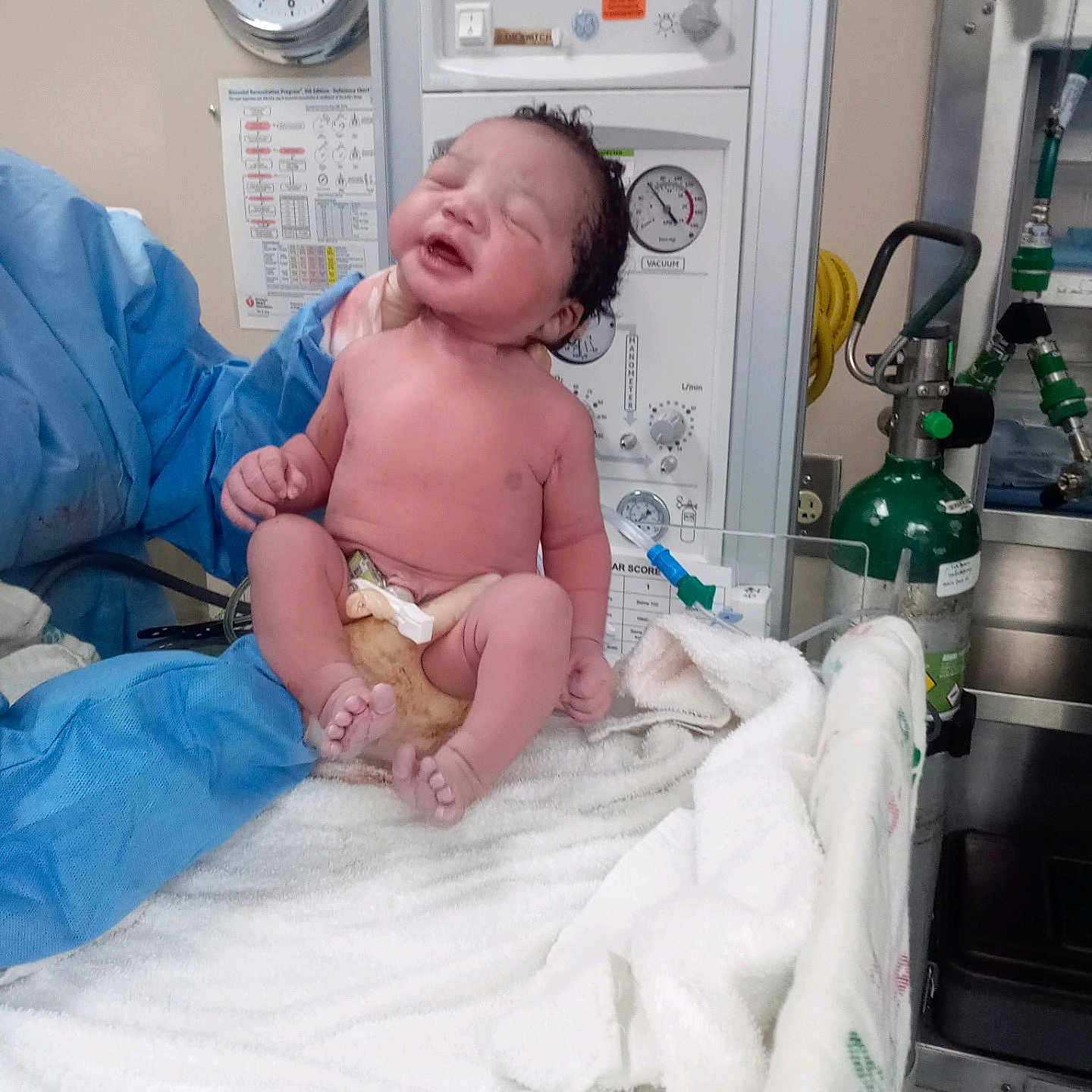 Amelia is registered to the contest to win money with this photo: architecture, baby, bed, blanket, building, childbirth, clinic, clothing, diaper, face, furniture, glove, head, hospital, indoors, newborn, operatingtheatre, person, photography, portrait