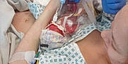Skylar Grace is registered to the contest to win money with this photo: child, comfort, elbow, event, health_care, hospital, human_leg, knee, linens, medical, medical_equipment, medical_glove, medical_procedure, patient, pattern, plastic, plastic_bottle, room, service, textile