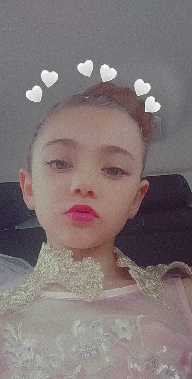 Clara a rejoint le concours — aidez-le/la à gagner de superbes lots ! chin, dress, embellishment, eye, eyebrow, eyelash, face, flash_photography, forehead, hairstyle, head, iris, jaw, lip, neck, person, shoulder, skin, textile, wedding_dress