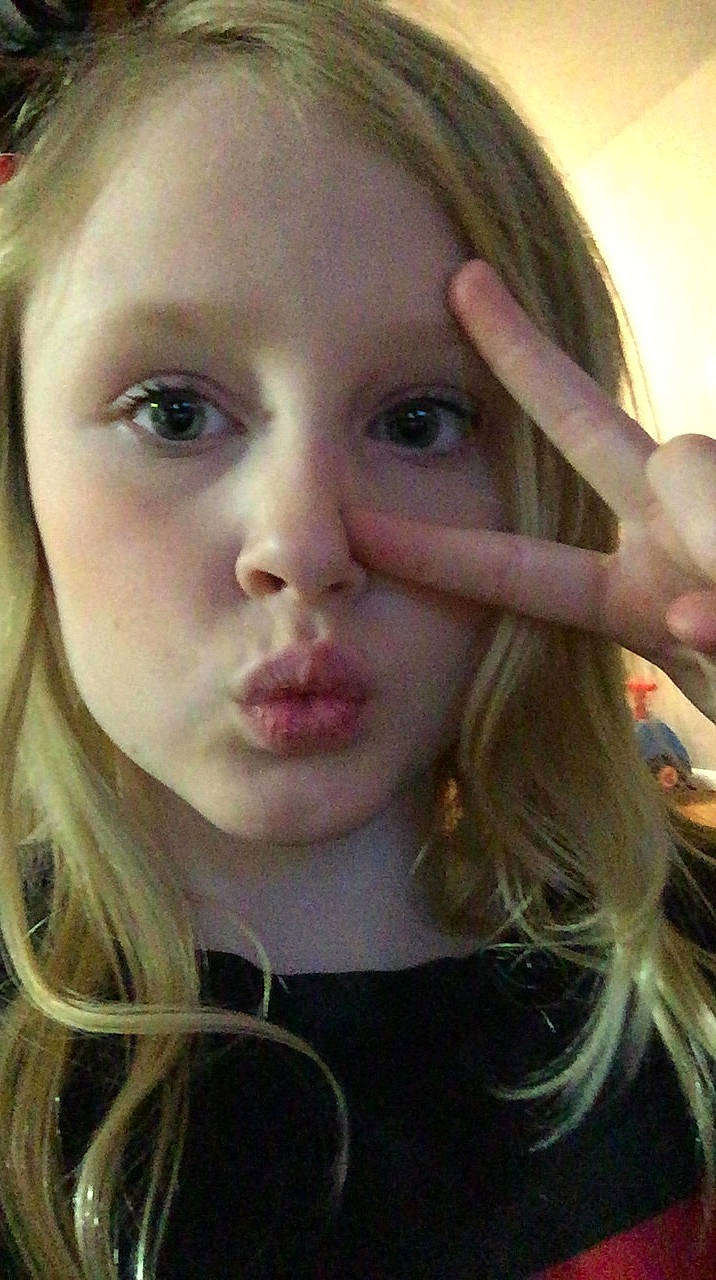 Amelia is registered to the contest to win money with this photo: cheek, chin, ear, eyebrow, eyelash, eyewear, facial_expression, forehead, gesture, hearing, human, iris, jaw, lip, mammal, mouth, neck, nose, person, skin