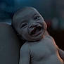 baby, infant, smile, cleft_lip, portrait, closeup, skin, diaper, child, young, face, expression, human, newborn, head, arm, lighting, blurred_background, indoor, person
