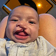 Daxen joined the competition — help win amazing prizes! baby, infant, smiling, cleft_lip, face, portrait, clothing, human, skin, person, cute, child, road_sign, yellow, traffic_sign, background, lap, sitting, indoors, closeup