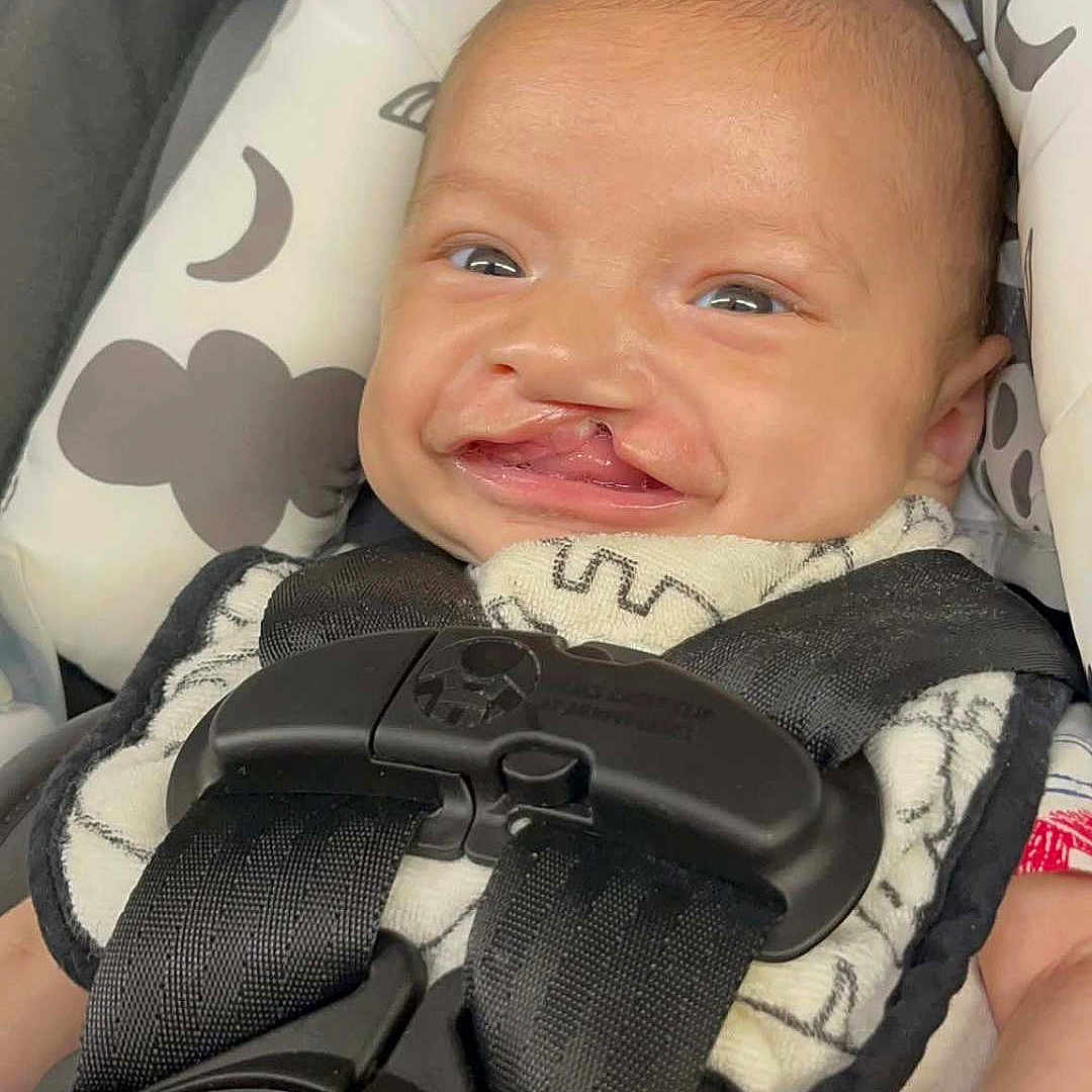 Daxen is registered to the contest to win money with this photo: baby, baby_clothing, black_straps, car_seat, child, cleft_lip, close_up, comfort, cushion, face, hand, head, indoor, infant, pattern, person, portrait, red_button, seatbelt, smiling