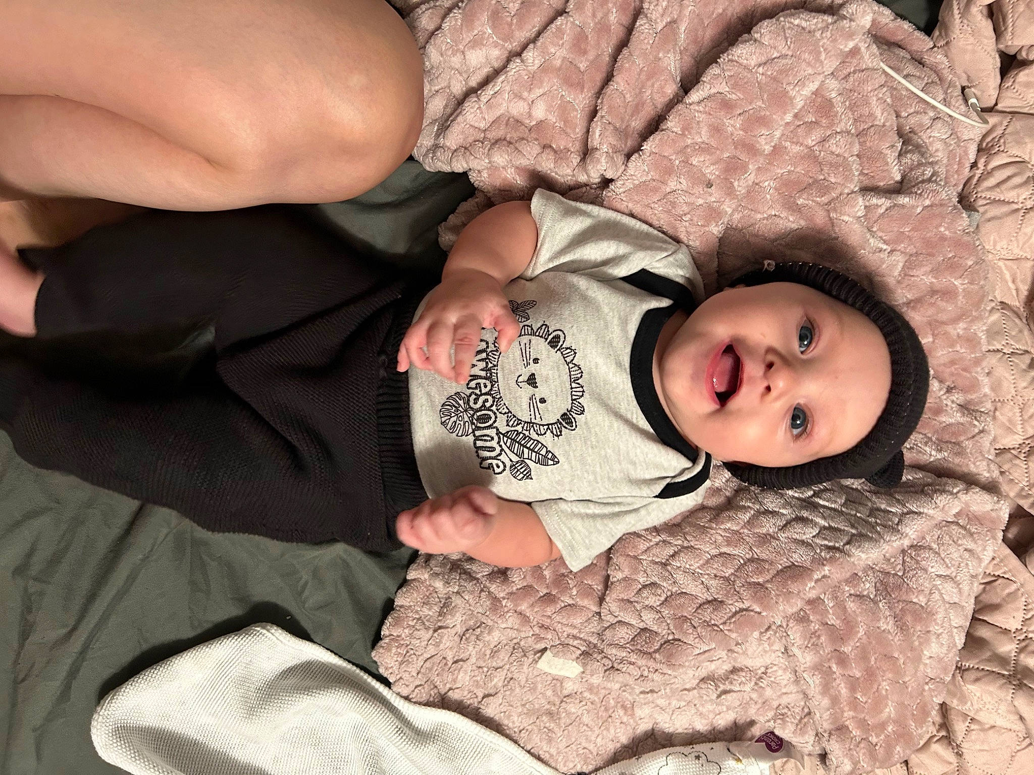 Ashton joined the competition — help win amazing prizes! baby, baby_toddler_clothing, cheek, child, comfort, dress, eye, finger, flash_photography, gesture, grass, hand, head, headwear, human_body, person, sitting, skin, sleeve, toddler