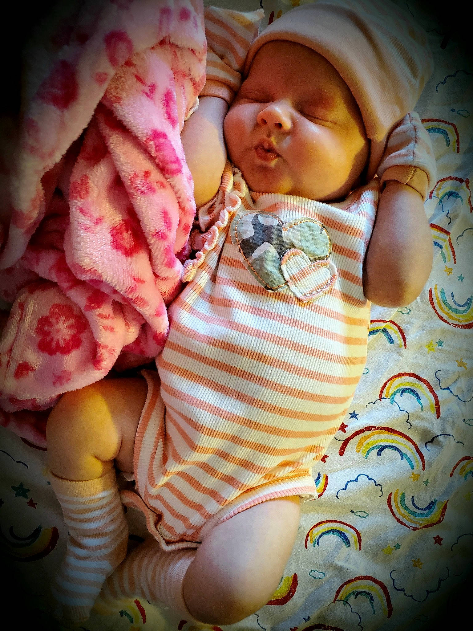 Lorraina is registered to the contest to win money with this photo: baby, baby_products, baby_safety, baby_sleeping, baby_toddler_clothing, bedtime, cheek, child, comfort, flesh, headwear, linens, mouth, pattern, peach, person, pink, room, skin, thigh