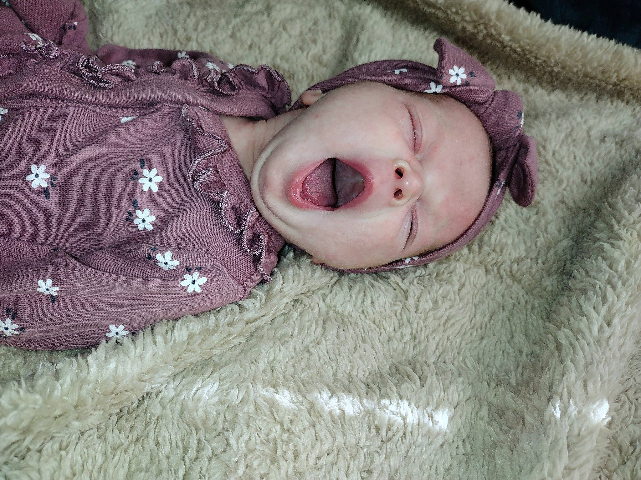 Kinsleigh is registered to the contest to win money with this photo: baby, baby_toddler_clothing, cheek, child, comfort, eye, eyelash, face, fur, grass, head, headgear, iris, lip, nose, person, skin, sleeve, textile, toddler