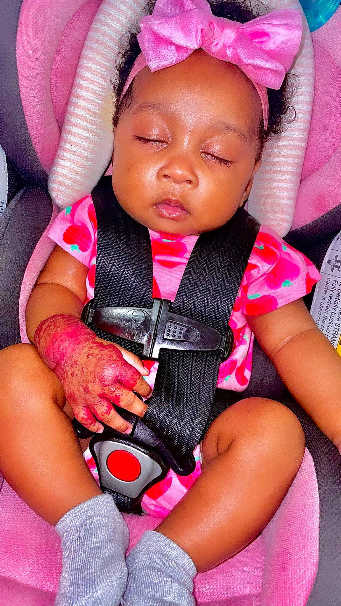 Lauryn joined the competition — help win amazing prizes! arm, baby_toddler_clothing, black, cheek, comfort, eyelash, facial_expression, finger, hand, happy, leg, lip, mouth, nail, person, pink, product, shorts, skin, thigh