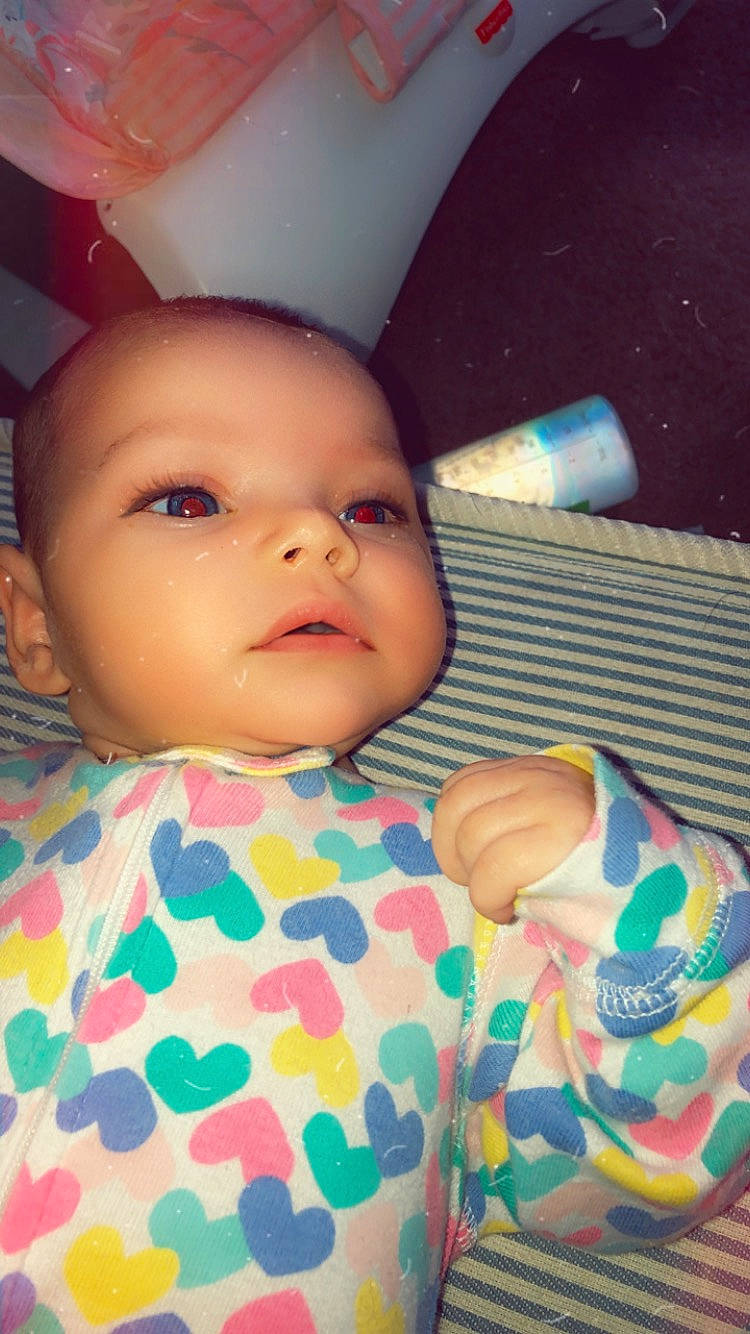 Avalyn is registered to the contest to win money with this photo: baby, cheek, child, eye, face, forehead, head, iris, lip, mouth, nose, person, pink, skin, toddler