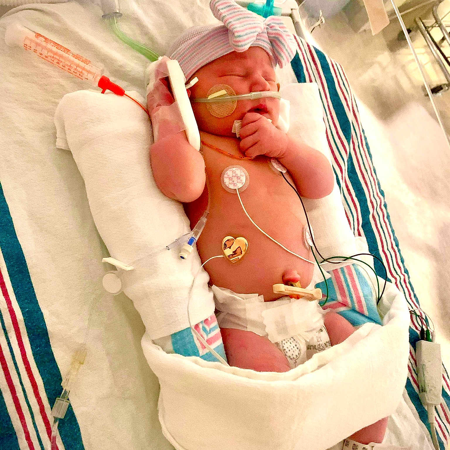 Paisley is registered to the contest to win money with this photo: abdomen, arm, baby, bathing, carmine, chest, child, elbow, event, flesh, headgear, health_care, hospital, hospital_bed, human_leg, medical, medical_procedure, patient, service, trunk