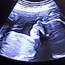 fetus, unborn_baby, ultrasound, prenatal, pregnancy, medical_imaging, womb, embryo, developing_baby, baby_profile, hand, face, curled_position, sonogram, healthcare, obstetrics, maternal_health, medical_screen, black_and_white, expectant_parent
