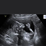 Ryiah is registered to the contest to win money with this photo: abdomen, black_and_white, chest, flesh, hand, joint, medical, medical_imaging, medical_radiography, muscle, neck, obstetric_ultrasonography, photography, radiography, radiology, service, text