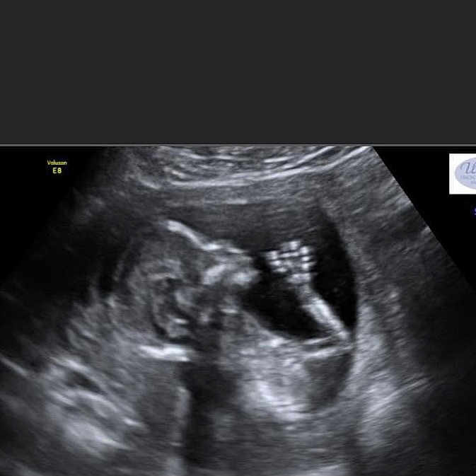 Ryiah