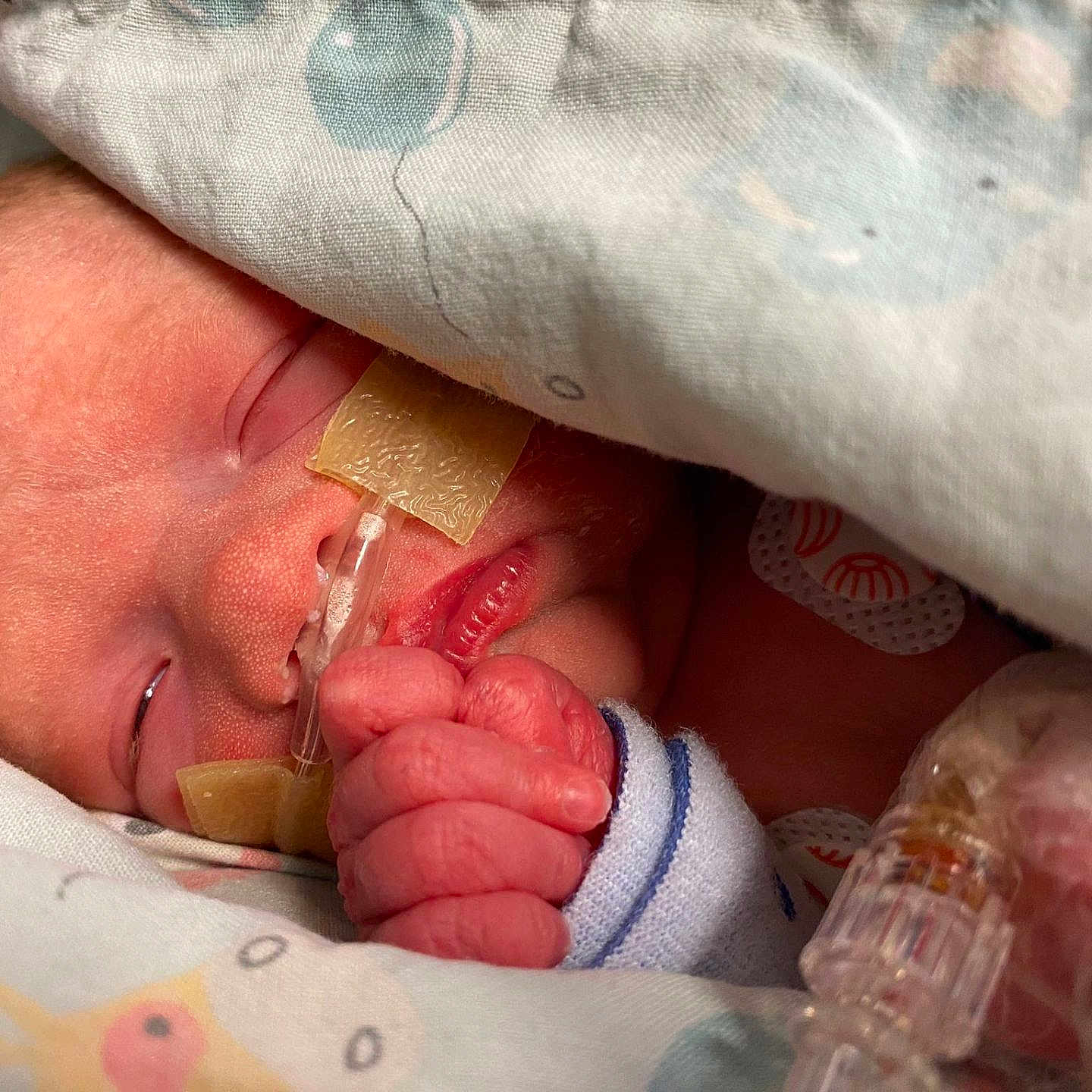 Harriet-Louise Diane is registered to the contest to win money with this photo: baby, blanket, closeup, cute, fragile, hand, healthcare, hospital, infant, iv_line, medical_tape, nasal_tube, newborn, peaceful, person, resting, skin, sleeping, soft, tiny