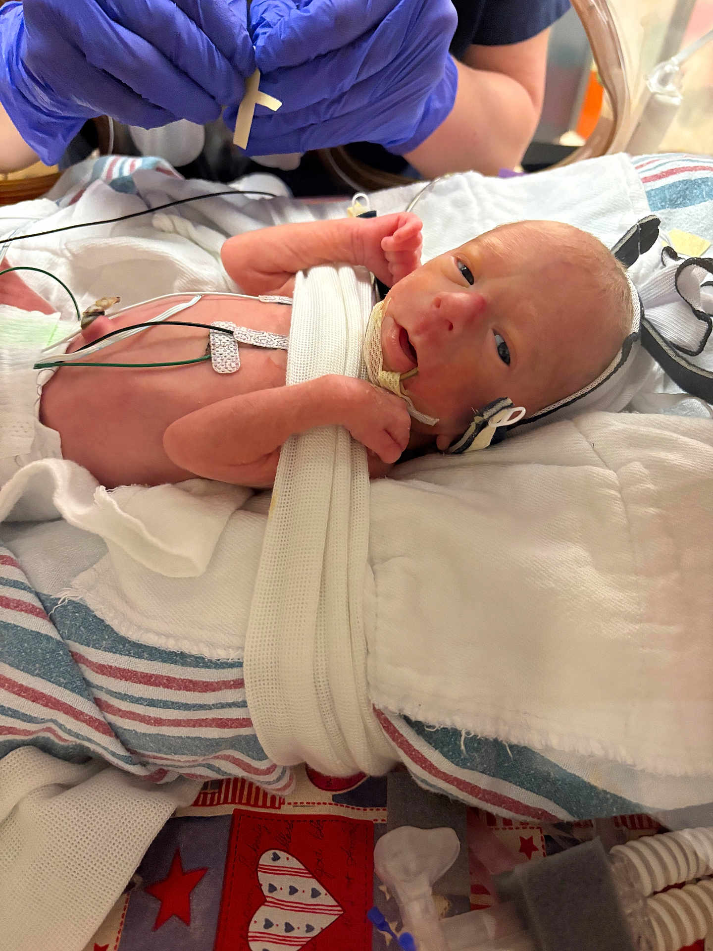 Walker joined the competition — help win amazing prizes! newborn, baby, infant, hospital, medical_equipment, blanket, gloved_hand, cross, bed, sensor, care, healthcare, patient, tubes, monitoring, tiny, premature, lying_down, person, closeup