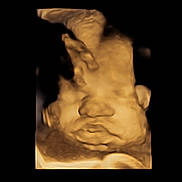 Aaliyah joined the competition — help win amazing prizes! art, artifact, chest, event, flesh, font, gesture, human_anatomy, jaw, medical, medical_imaging, medical_radiography, mouth, radiology, screenshot, sculpture, service, statue, trunk, visual_arts