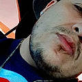 Romero R.