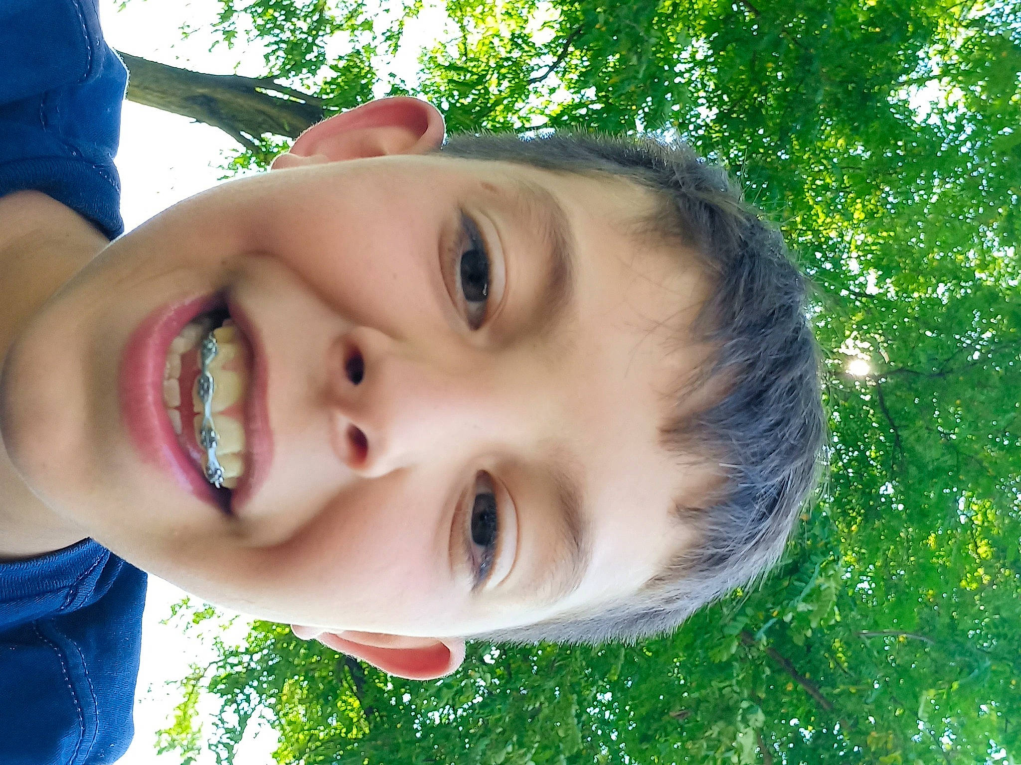 Sasuke participe au concours pour gagner de l'argent avec cette photo : cheek, eyebrow, eyelash, face, facial_expression, forehead, human_body, iris, jaw, joy, lip, mouth, nose, people_in_nature, person, photograph, plant, skin, smile, tree