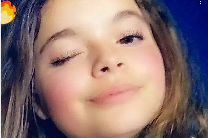 Melanie participe au concours pour gagner de l'argent avec cette photo : beauty, cheek, child, chin, close_up, eye, eyebrow, eyelash, face, forehead, hair, hairstyle, head, jaw, lip, mouth, nose, organ, person, skin