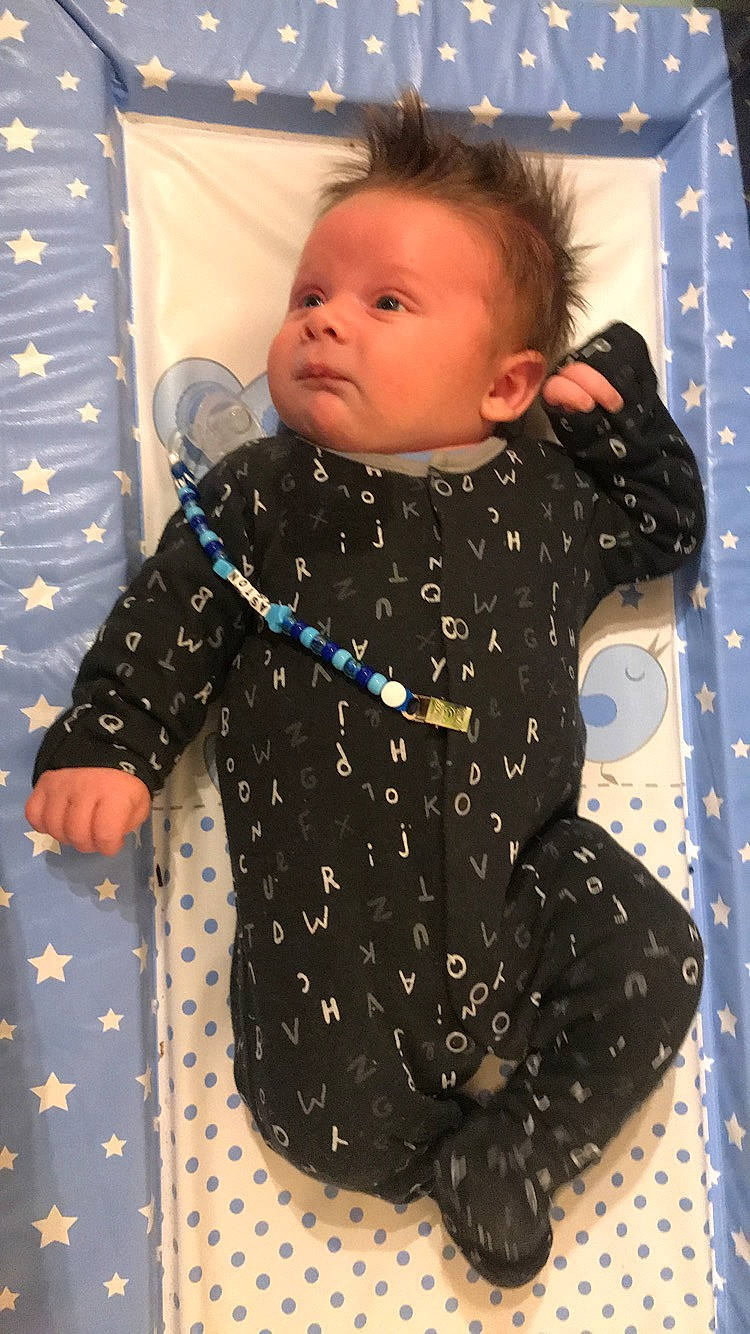 Aston is registered to the contest to win money with this photo: baby, baby_toddler_clothing, cheek, child, head, outerwear, pattern, person, polka_dot, skin, sleeve, textile, toddler