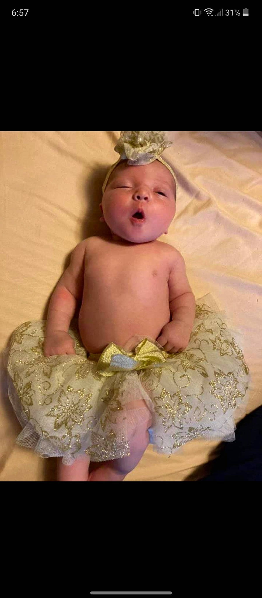 Paris is registered to the contest to win money with this photo: abdomen, arm, baby, baby_products, baby_sleeping, baby_toddler_clothing, chest, child, comfort, happy, headpiece, iris, jewellery, linens, person, skin, stomach, textile, thigh, toddler