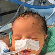 Mya a rejoint le concours — aidez-le/la à gagner de superbes lots ! baby, infant, sleeping, medical_tubes, hospital, blanket, face, tape, healthcare, newborn, person, closeup, bed, care, resting, soft, cute, indoors, equipment, fragile