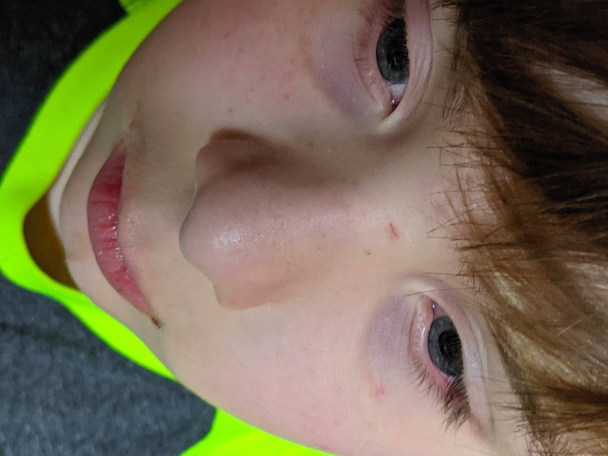 Raiden joined the competition — help win amazing prizes! cheek, ear, eye, eyebrow, eyelash, eyewear, forehead, fun, grass, hair, head, human_body, iris, jaw, lip, mouth, neck, nose, skin, smile