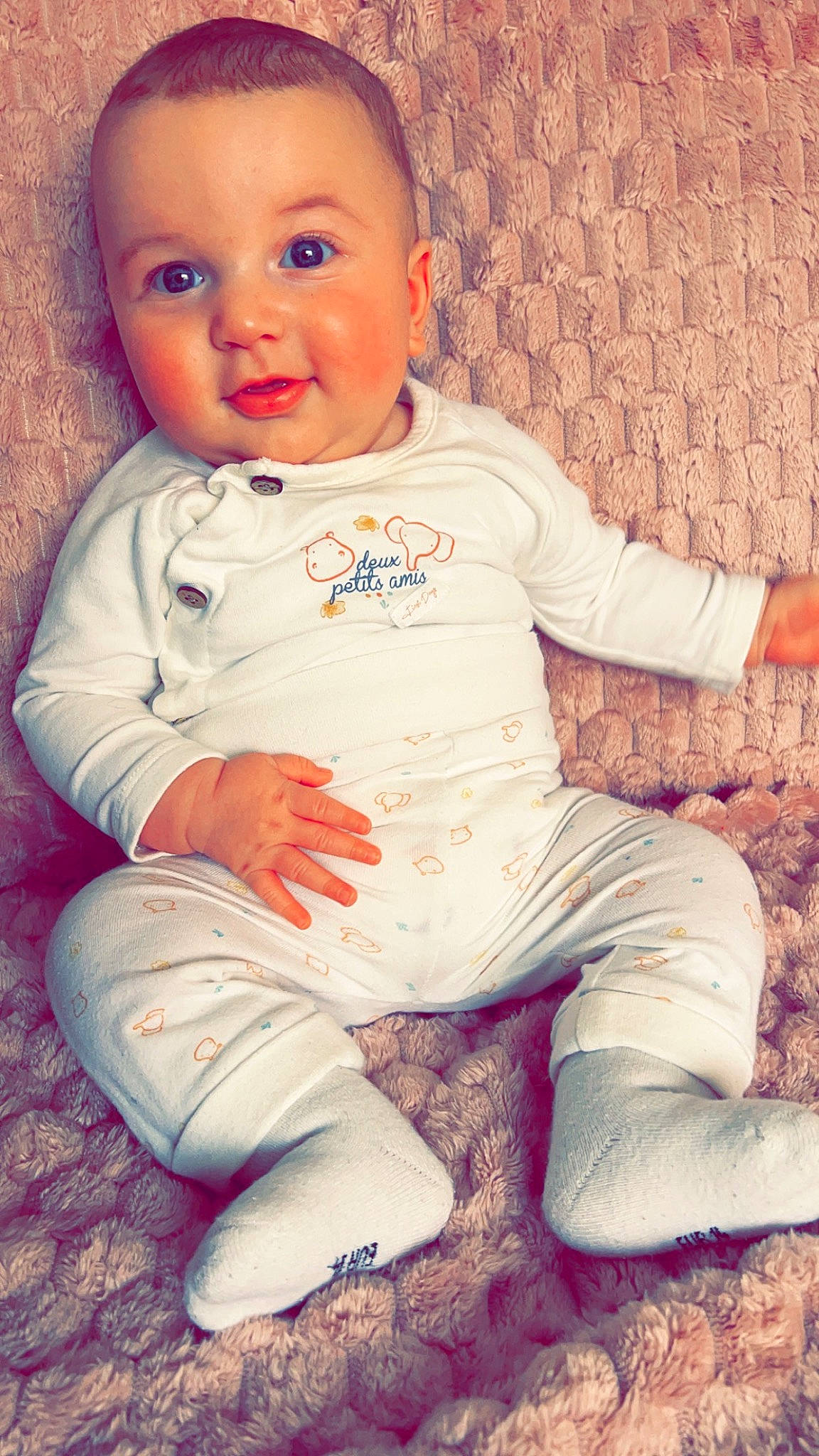 Giulio a rejoint le concours — aidez-le/la à gagner de superbes lots ! arm, baby, baby_toddler_clothing, cheek, child, comfort, dress, grass, happy, iris, lip, nose, pattern, person, pink, sitting, skin, sleeve, standing, t_shirt