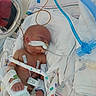 newborn, baby, incubator, hospital, medical_tubes, monitoring_devices, blanket, heart_pattern, bandages, electrodes, infant, healthcare, patient, premature, resting, medical_care, hospital_bed, respirator, swaddled, tiny